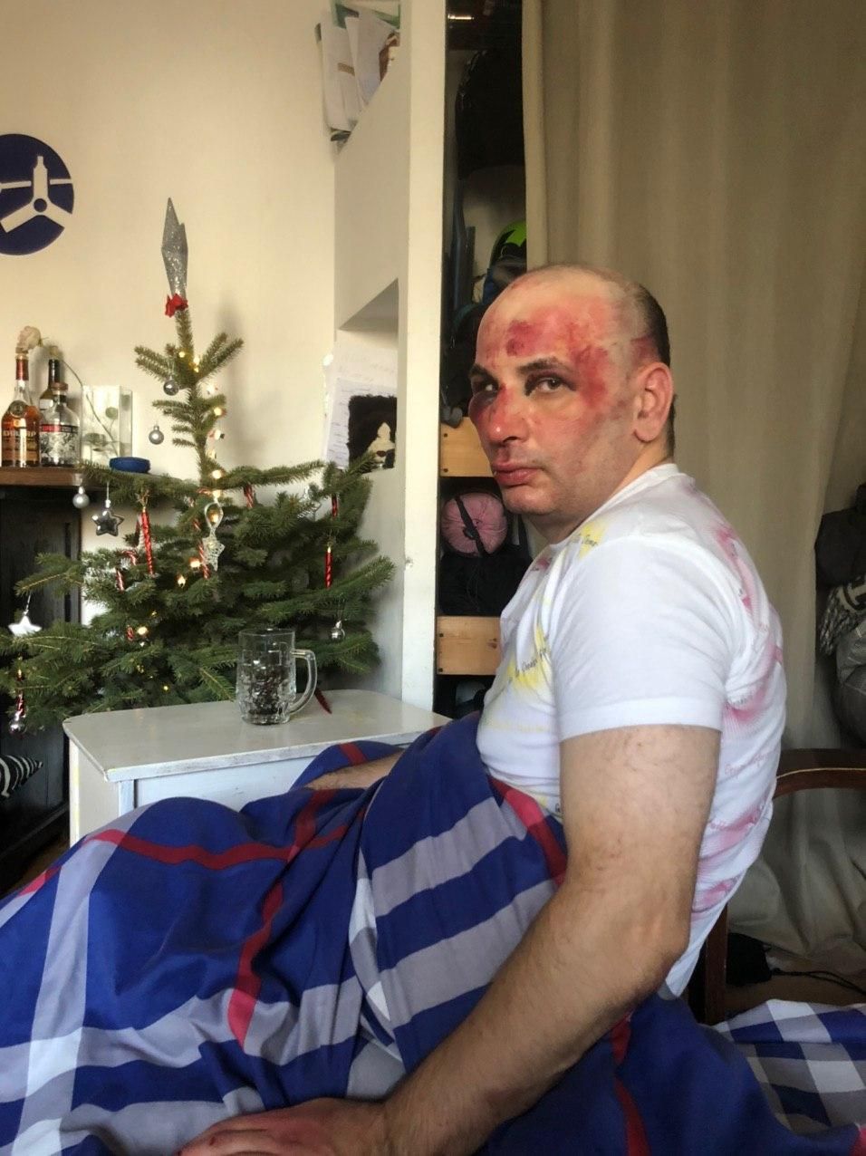 Жесткое избиение учителя истории попало на камеру видеонаблюдения в Пятигорске