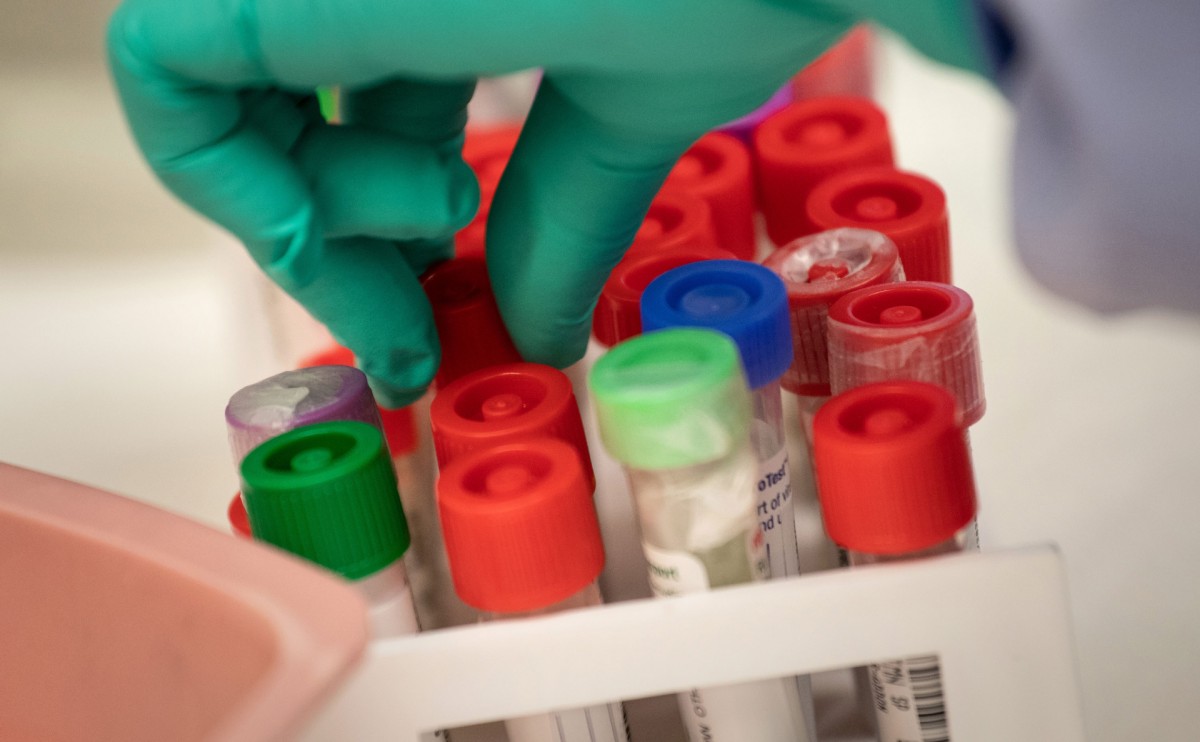 На Ставрополье умер пятый пациент с коронавирусом