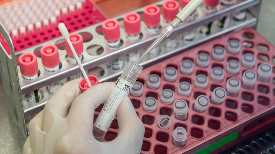 На Ставрополье скончались еще три пациента с коронавирусом