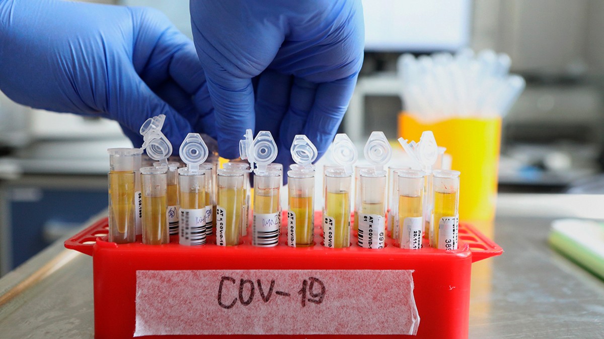 На Ставрополье 80 человек излечились от коронавируса