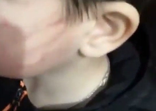 Губернатор Владимиров прокомментировал инцидент с избиением ребенка в детсаду на Ставрополье Губернатор Владимиров прокомментировал инцидент с избиением ребенка в детсаду на Ставрополье