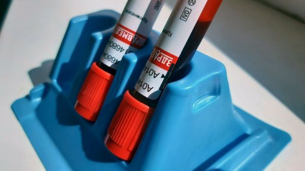 Что вы знаете о ВИЧ?