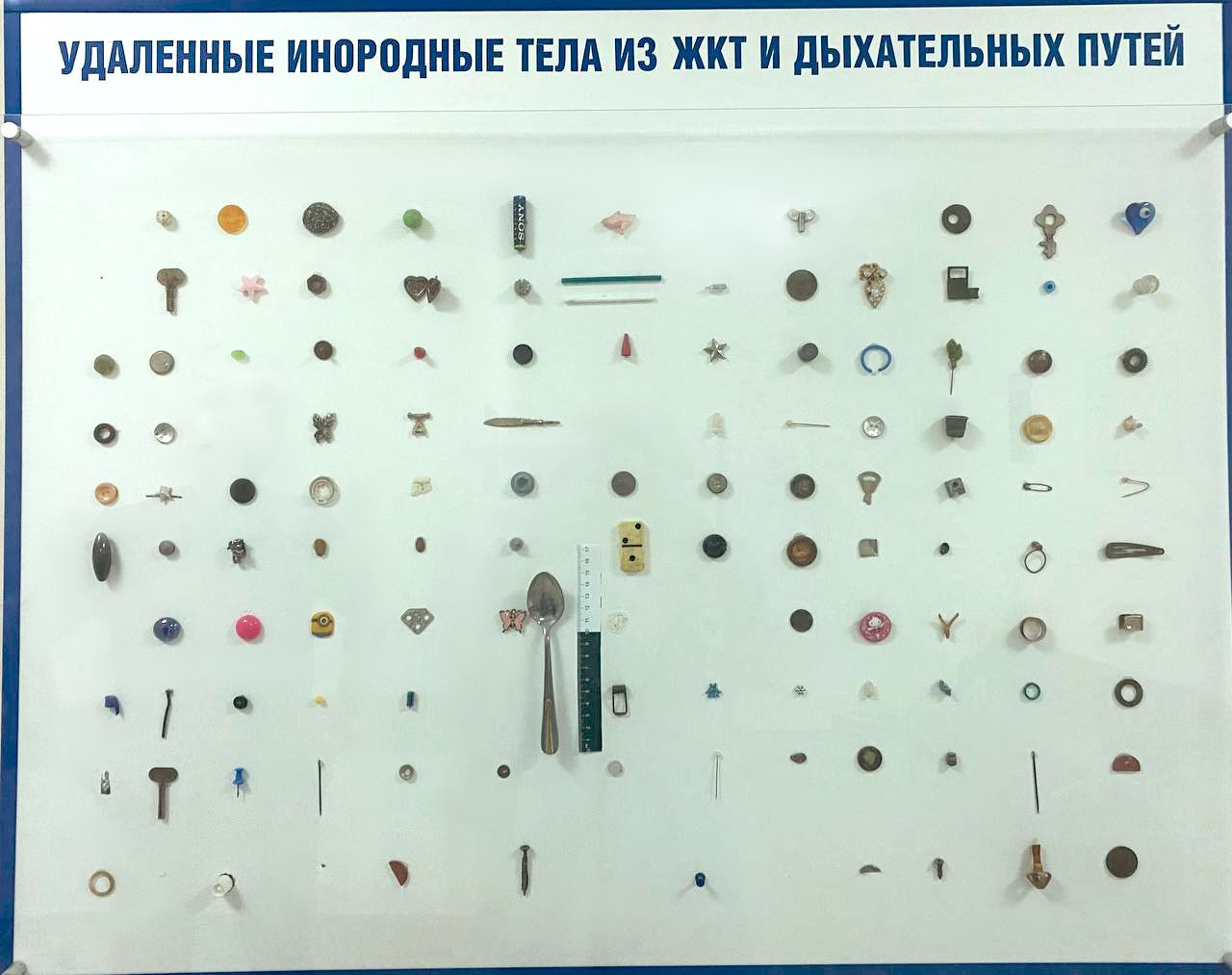 Саморез, шампунь, швейная игла: какие еще предметы извлекают из маленьких пациентов врачи в Ставрополе?
