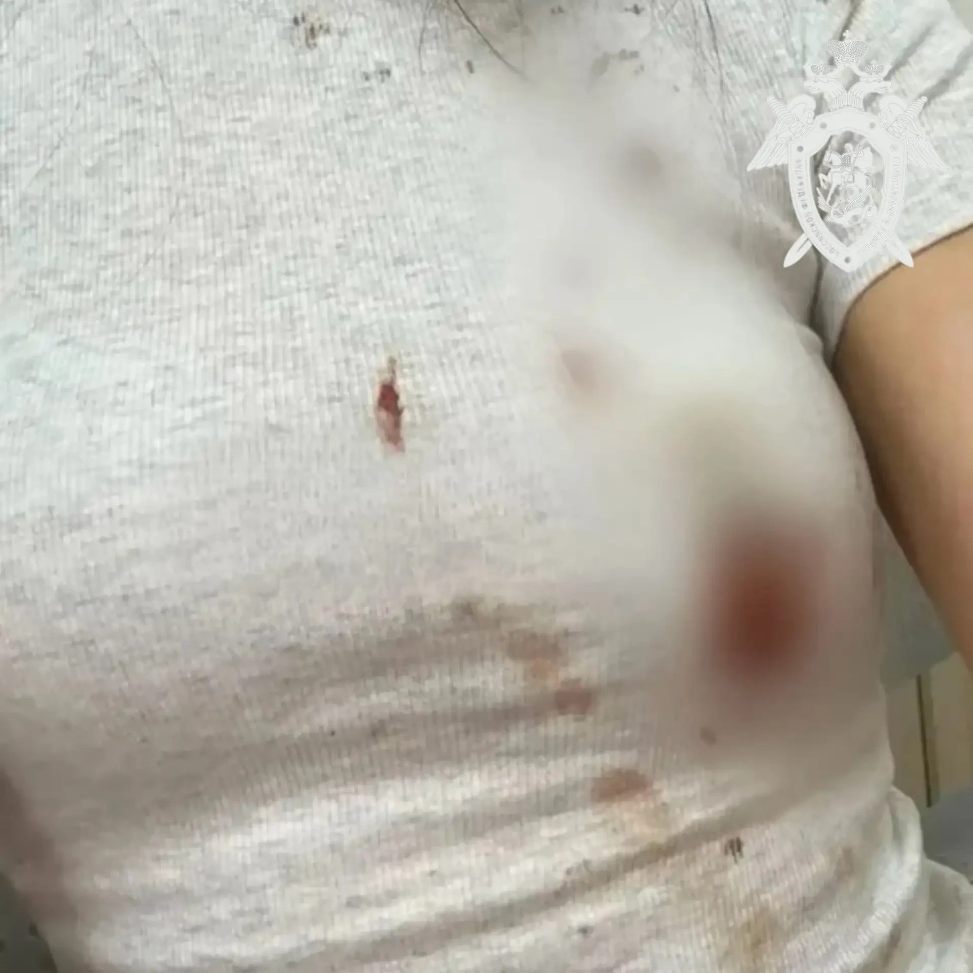 Бродячие собаки напали на девушку и ее питомца в Ессентуках